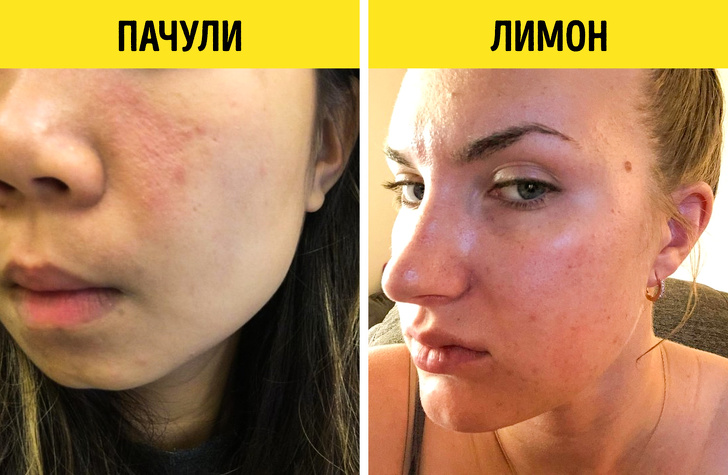 12&nbsp;секретов эфирных масел, о&nbsp;которых знают только косметологи
