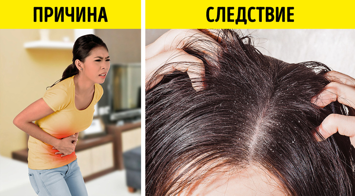 Что состояние волос может рассказать о&nbsp;вашем здоровье