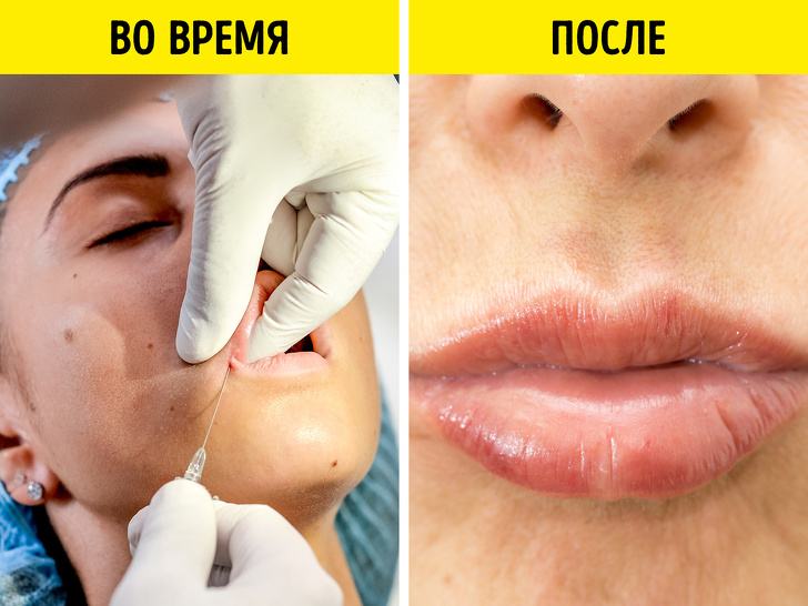 9&nbsp;популярных салонных процедур, которые сами косметологи ни&nbsp;за&nbsp;что делать не&nbsp;станут