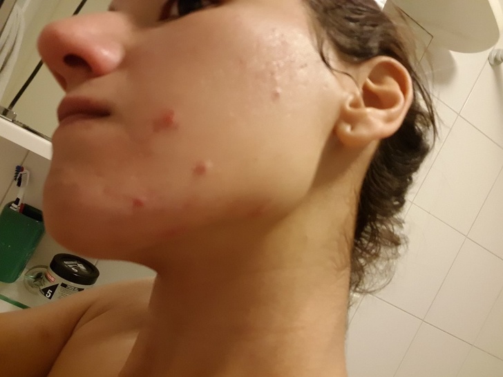 Блогер показала, как изменилось ее лицо за 3 недели мясного питания после 4 лет веганства