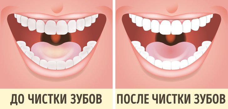 10&nbsp;неочевидных тревожных сигналов кишечника, которые не&nbsp;стоит игнорировать
