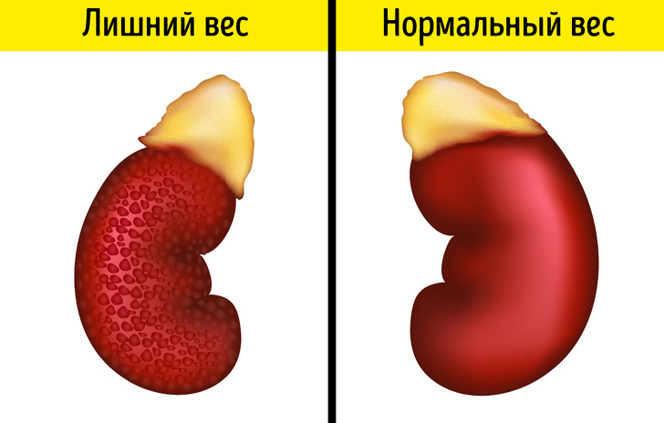 Что происходит с&nbsp;организмом, когда вы&nbsp;теряете лишние килограммы