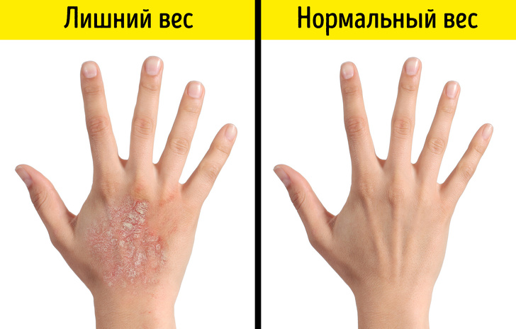 Что происходит с&nbsp;организмом, когда вы&nbsp;теряете лишние килограммы